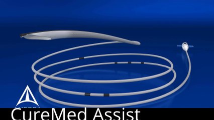 Uterine Fibroid Embolization 3D Medical Animation – CureMed Assist – Medical Tourism Company