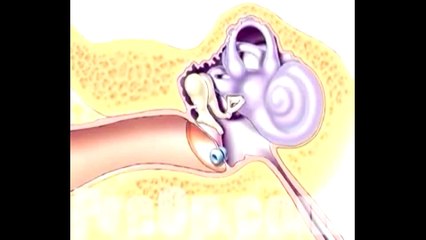 Patient Education Myringotomy Insertion of Tube 4 – CureMed Assist – Medical Tourism Company