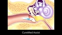 Patient Education Myringotomy Insertion of Tube Surgery – CureMed Assist – Medical Tourism Company