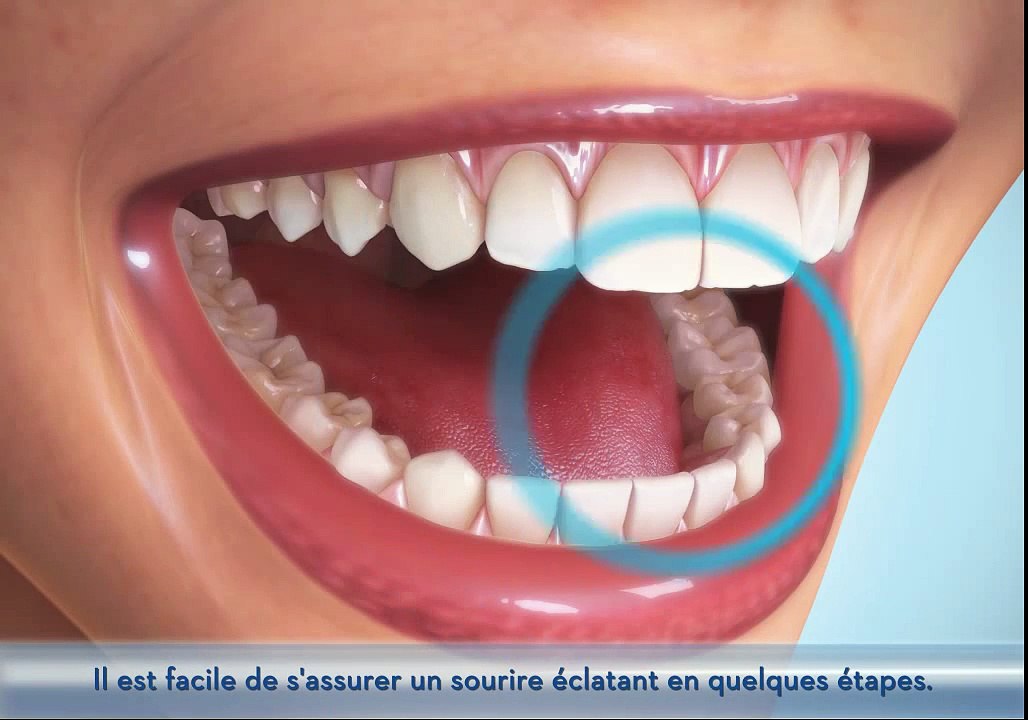 Taches dentaires - Raisons et Solutions Oral-B 3D White