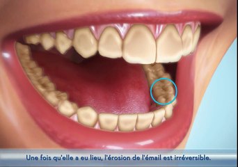 Erosion de l’émail - Prévention et Conseils Oral-B Pro-Expert