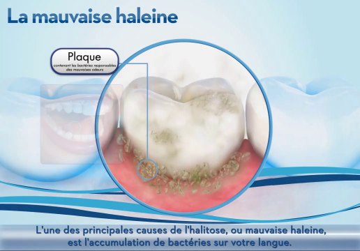 Mauvaise haleine - Conseils, Astuces & Solutions Oral-B