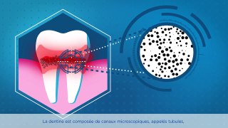Quelles sont les causes de la sensibilité dentaire ?