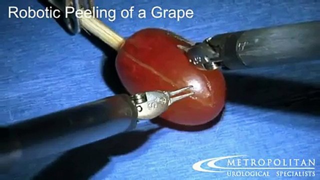 Чудо хирургической техники-аппарат чистит виноградинку