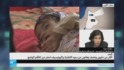 الجوع يقتل الأطفال في اليمن