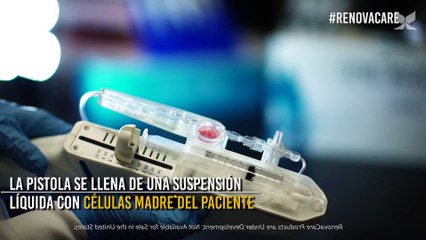 Medicina del siglo XXI: esta pistola promete sanar quemaduras en tan solo 4 días