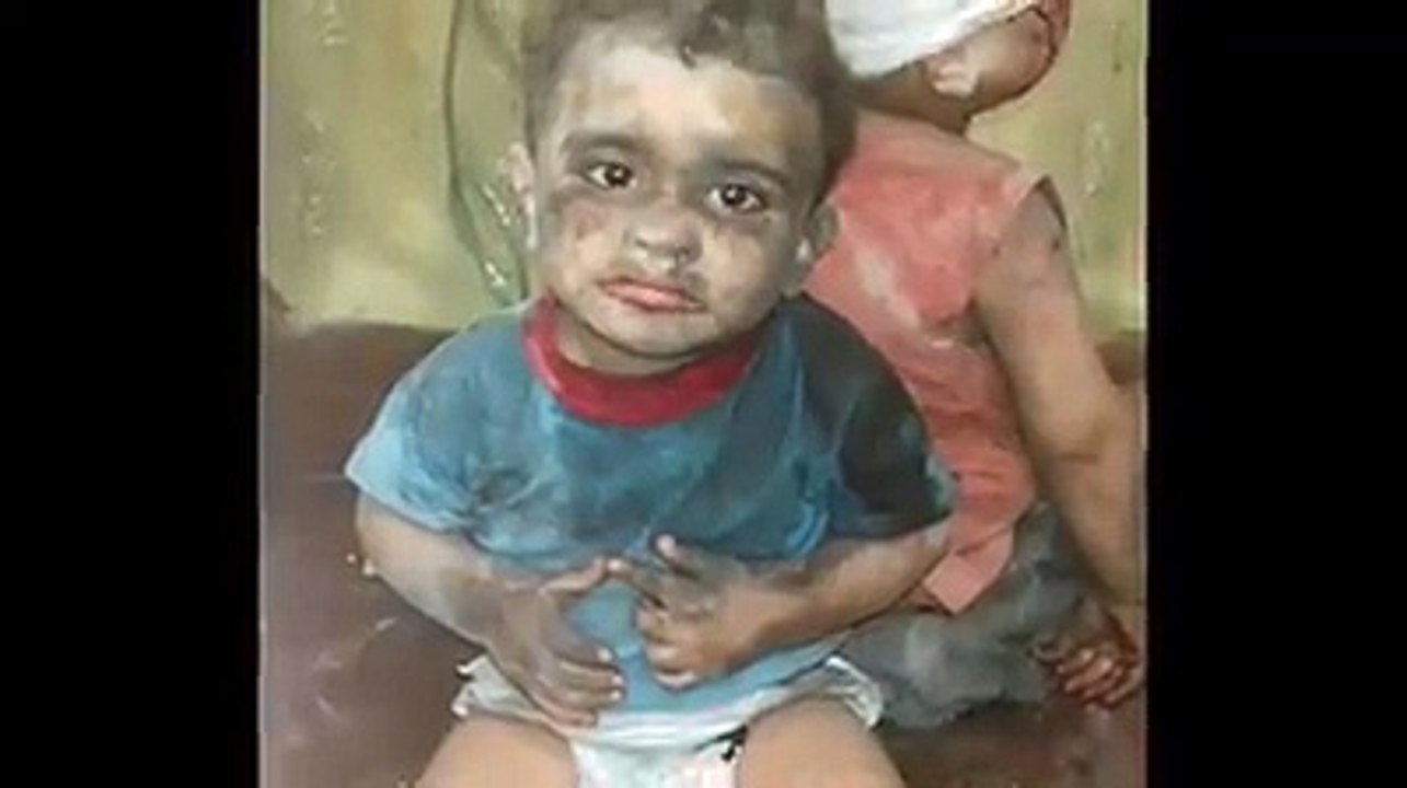 Halep Ölüyor..!