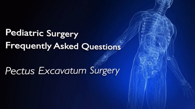 Pectus Excavatum Surgery Will I Feel the Bar Q&A – CureMed Assist – Medical Tourism Company