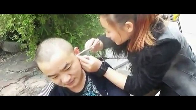 Chinese Ear Cleaning (12) Helping a bald man to remove ear wax