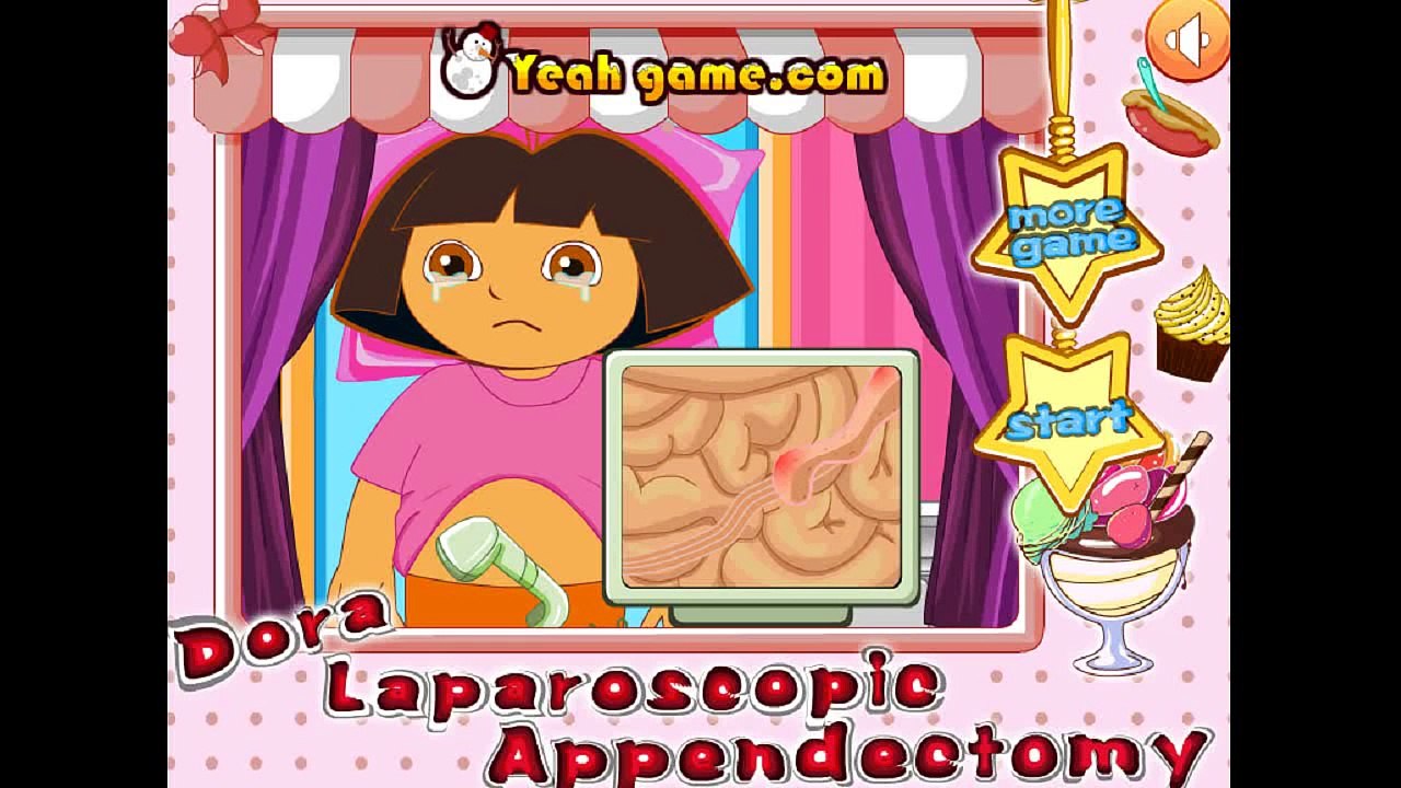 Dora laparoscopic appendectomy
