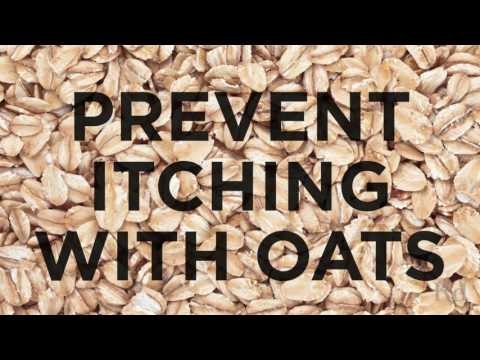 Home Remedies for Burns