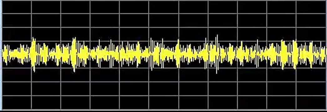 Cancer (General) - Rife Frequencies