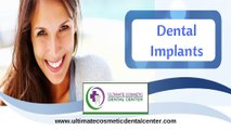 Best Dental Implant Center in Goa | Dental Implants in India