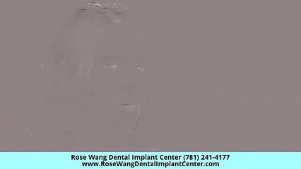 Best Dental Implants Lexington MA