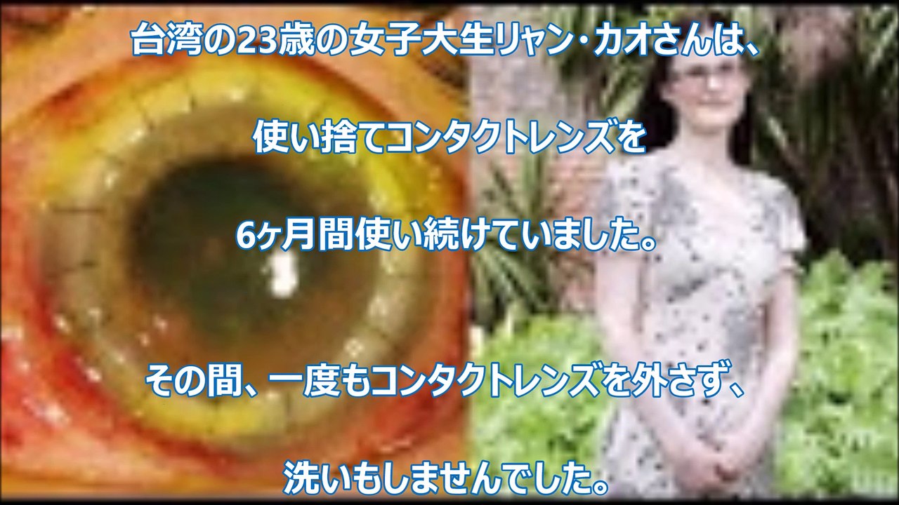 【衝撃的】コンタクトレンズを10年間連続使い続けた結果・・・【驚愕】