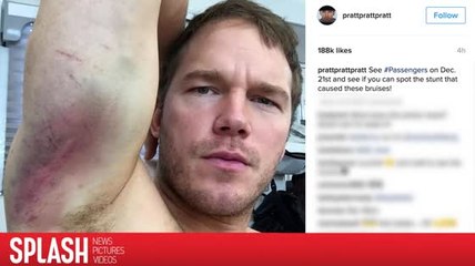 Chris Pratt zeigt seine blauen Flecken von seinen "Passengers" Stunts
