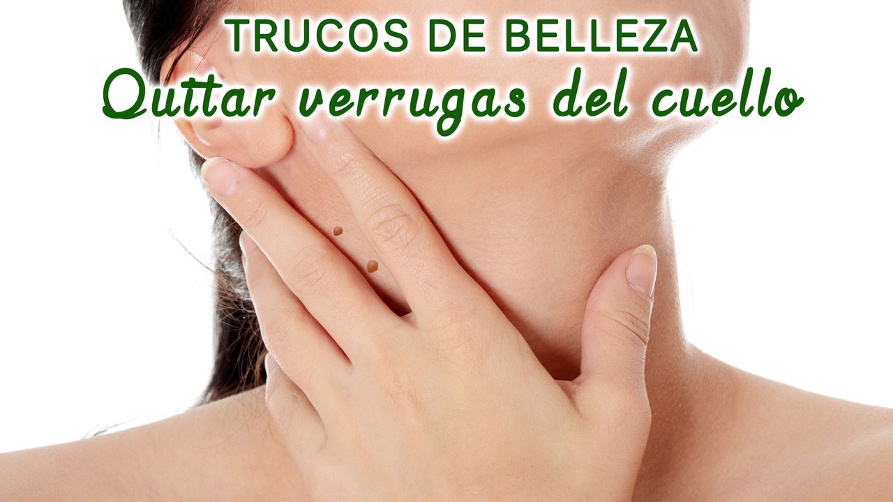 Eliminar las verrugas del cuello, senos, pecho, axilas, manos y pies