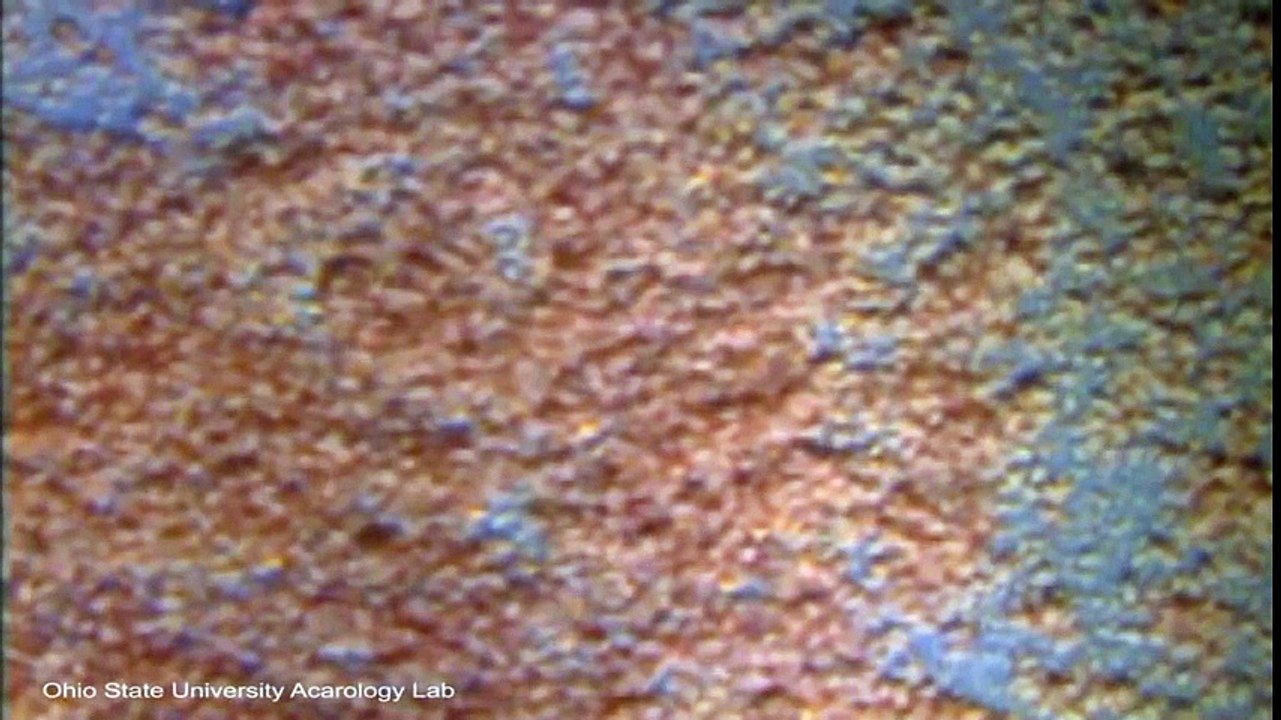 É Isto Que Acontece Com O Teu Corpo Quando Não Lavas A Roupa Da Cama. Não Podes Adiar Mais!