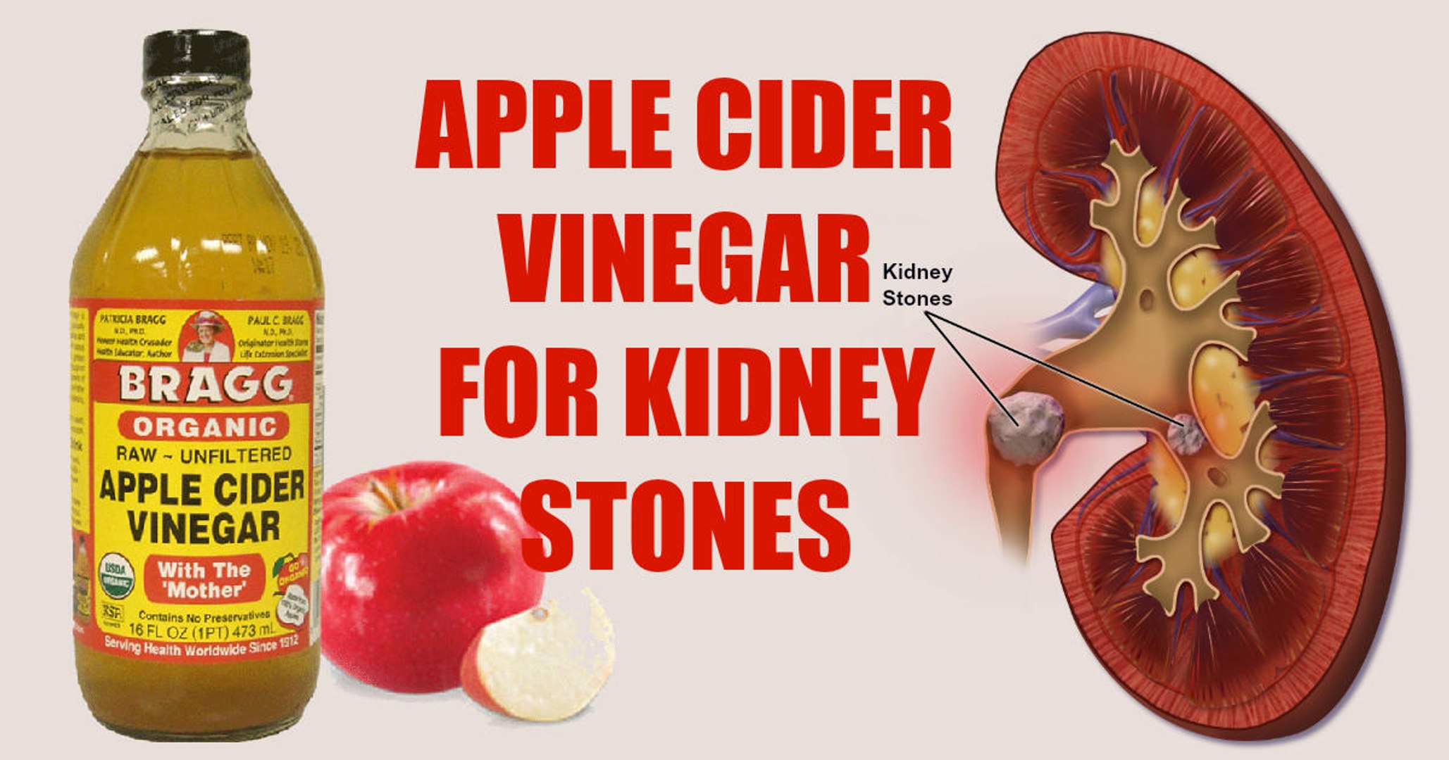 ⁣Effective Natural Remedies For Kidney Stones