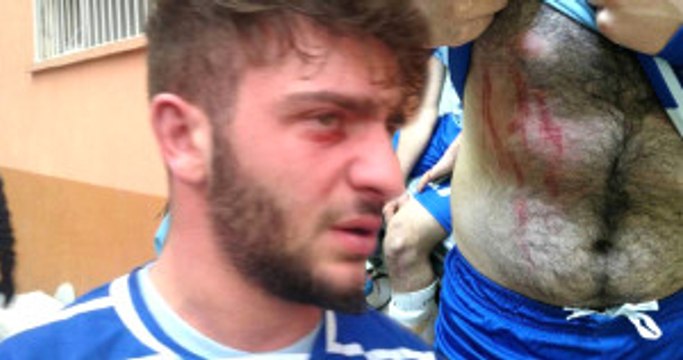 Rize'de Amatör Futbol Maçında Kavga Çıktı, 2 Futbolcu Yaralandı