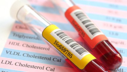 This Company Literally Wants Your Blood To Sell You Things