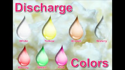 Vaginal Discharge │