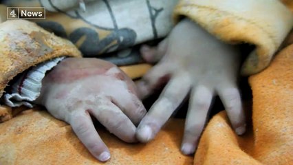 "Alepo, tashmë vendi ku loti i fëmijëve ka ndaluar". Ditët e fundit në vendin e harruar nga bota (Video)
