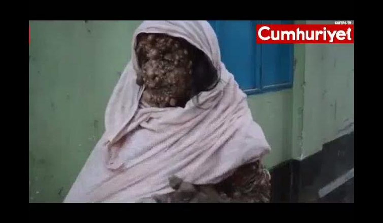 "Bu acıdan kurtulmanın tek yolu ölüm... Yaşamak istemiyorum"