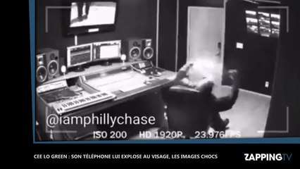 Cee Lo Green : Son téléphone lui explose au visage, les images chocs