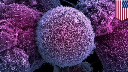 Cells that rise from the dead may spread cancer in the body