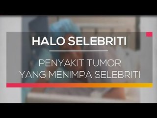 Penyakit Tumor yang Menimpa Selebriti - Halo Selebriti