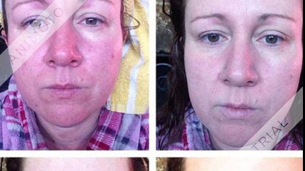 Kellie Skin Cream Review - Risk Free Trial for Flawless Glow! !!