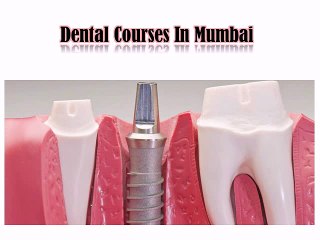 Best Family Dentists and Dental Implants