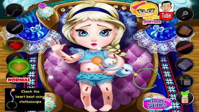 ᴴᴰ ღ Baby Elsa Injured ღ - Frozen Baby Elsa Injured Game - Baby Games (ST)