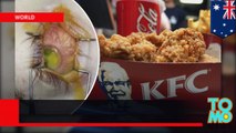 Adolescente fica cego após dieta com KFC e Coca Cola por 8 anos.