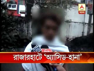 Miscreants throw acid on school girl at Rajarhat