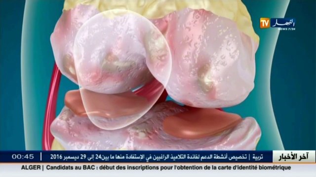 3 دقائق صحة آلام المفاصل.. أسبابها وكيفية الوقاية منها