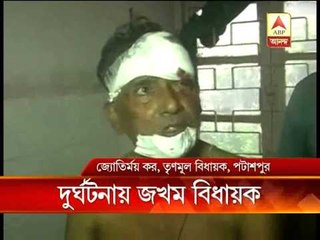 TMC MLA of Patashpur injured in a road accident