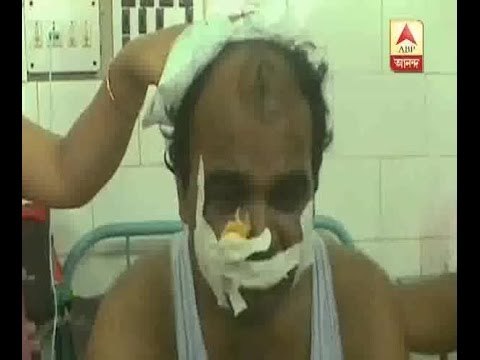 CPM MLA Insar Ali Biswas injured during strike