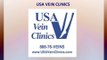 Varicose Veins: What are They and How Can Get Rid of Them?
