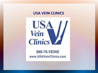 Varicose Veins: What are They and How Can Get Rid of Them?