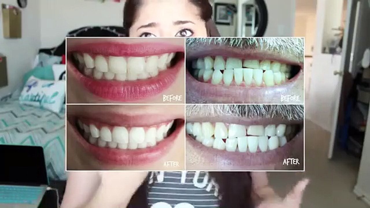 How to Whiten Teeth at Home