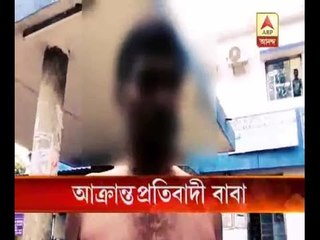 Protesting father attacked by the accused teacher at Nadia