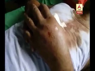 Again police attacked at Malda