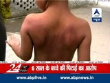Six-year-old brutally beaten up by teacher, accused arrested