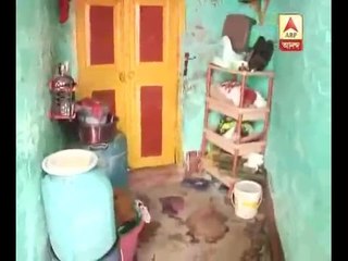 Woman allegedly burn by the in -laws