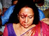 'Bedard' Hema Malini: Bollywood actress left the suffering family behind