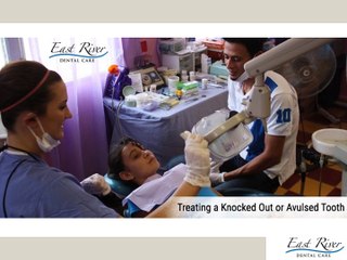 Treating a Avulsed Tooth - East River Dental Care - Newmarket - Ontario - Canada