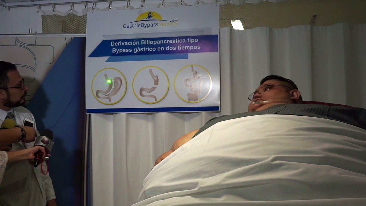 Dickster Mann der Welt will abspecken