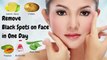 How to Remove Black Spots & Dark Spots on Face with 5 Home Remedies